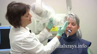 How to take dental xrays with bisecting angle positioning [upl. by Emlynne758]