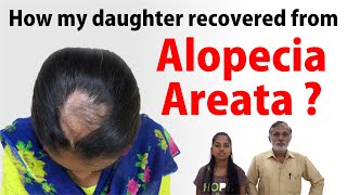 A Fathers Review about Dr Rohit Natural Treatment for ALOPECIA AREATA [upl. by Einrae]