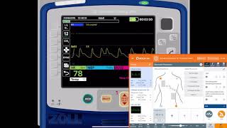 REALITi 360 14 12 Lead ECGs [upl. by Nonahs]