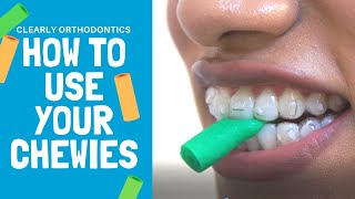 How to use Chewies  Invisalign Treatment [upl. by Eelrak]