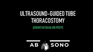 Ultrasoundguided tube thoracostomy [upl. by Palermo]