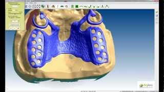 Logiciel CAO DIGISTELL pour la création de châssis squeletté pour prothésistes dentaires Part 2 [upl. by Evadne]