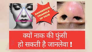 क्यों नाक की छोटी सी फुंसी जानलेवा हो सकती है Danger triangle of face [upl. by Anhaj904]