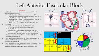 Left Anterior Fascicular Block [upl. by Sutelc562]