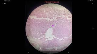 Histology of Pitutaryhypophysis cerebri gland slide identification and explanation [upl. by Yecart657]