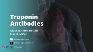 Whats a Macro Troponin and what should I do about it [upl. by Yartnod]