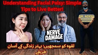 LIVING WITH LAQWA Facial Palsy Heres What You Need to Know [upl. by Coster]