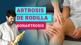 ¿QUÉ ES LA ARTROSIS DE RODILLA GONARTROSIS  PROLOTERAPIA  PRP  CÉLULAS MADRE [upl. by Klatt]