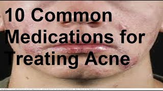 10 Common Medications for Treating Acne [upl. by Yras]