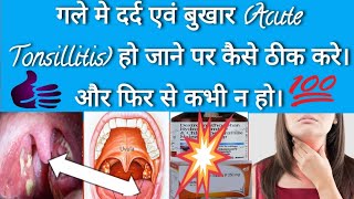 Tonsillitis गले मे दर्द एवं बुखार Acute Tonsillitis हो जाने पर कैसे ठीक करे। और फिर से कभी न [upl. by Huntington]