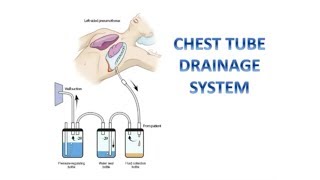 Managing CHEST TUBE DRAINAGE SYSTEM [upl. by Atikihc804]