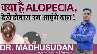 क्या है Alopecia देखें दोबारा उग आएंगे बाल   Hair Regrowth Treatments  Dr Madhusudan [upl. by Jabez]