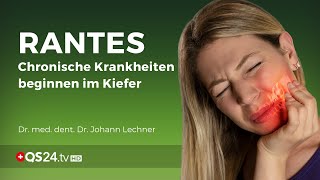 RANTES chronische Krankheiten beginnen im Kiefer  Dr med dent Dr Johann Lechner  NaturMEDIZIN [upl. by Eltsyrk426]