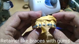 RETAINER LIKE BRACES WITH GUMS [upl. by Arerrac]