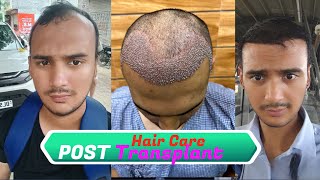 Unlock Perfect Results  MustKnow Hair Care After Transplant  Watch After Hair Transplant for hair [upl. by Sualokin]