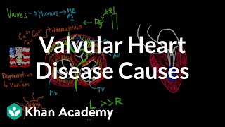 Valvular heart disease causes  Circulatory System and Disease  NCLEXRN  Khan Academy [upl. by Gniliem]