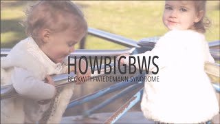 BeckwithWiedemann Syndrome  What is BWS [upl. by Giwdul]