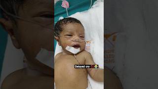 Baby didnt cry after birth nicu serious birth asphyxia [upl. by Chloris426]