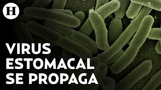 Extraño virus estomacal se propaga en EU estos son los síntomas de la shigelosis [upl. by Akirdnahs920]