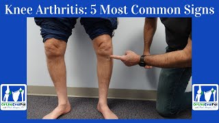 Knee Arthritis 5 Most Common Signs You Have It [upl. by Tdnaltroc]