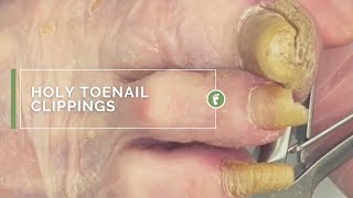 HOLY TOENAIL CLIPPINGS [upl. by Kordula]