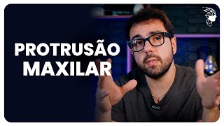 Protusão Maxilar O que é e como tratar  Dr Maurício Demétrio [upl. by Ellenyl]