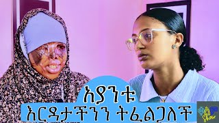 🛑አያንቱ እርዳታችንን ትፈልጋለች🛑 Ayantu needs our help [upl. by Lsiel]