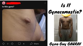 How to check Gynecomastia  Is it Gyno PART1 [upl. by Winograd]