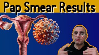 Pap Smear 101  Explained Pap Smear results meaning Pap Test [upl. by Rebmyt463]