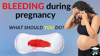 Bleeding in Early Pregnancy What Should YOU Do  Causes amp When to Worry pregnancybleeding [upl. by Radie739]