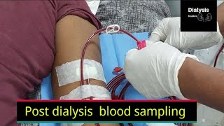 Pre and Post Dialysis Blood Sampling techniques Urea Reduction Ratio URR Part 1 [upl. by Minny]