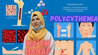 quotUnderstanding Polycythemia Causes Symptoms and Treatment Optionsquot [upl. by Cynera]