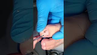 Trimming nails November 16 video 1 [upl. by Evonne767]