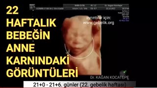 22 haftada anne karnındaki bebeğin dört boyutlu ultrason görüntüleriDr Kağan Kocatepe [upl. by Noivert974]