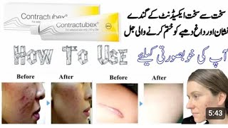 contractubex Gel  how to use contractubex [upl. by Omolhs653]