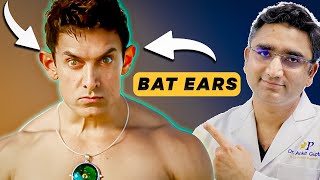 Bat Ears Or Prominent Ears Solution By Dr Ankit Gupta [upl. by Templia]