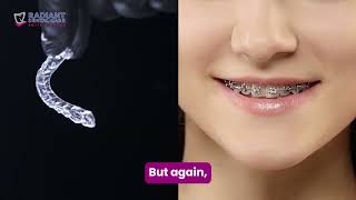 Aligners vs Braces Which is Faster for Your Perfect Smile [upl. by Anhsirk]