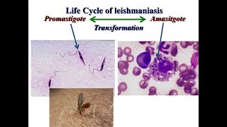 LEISHMANIASIS  Parasitología Botero y ´´Becerril´´ Resumen [upl. by Hartmunn816]