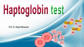 Haptoglobin Test تحليل هابتوجلوبين [upl. by Rozella]