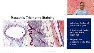 MD DNB Practical CONNECTIVE TISSUE STAINS Massons Trichrome Univ Exam [upl. by Esilehc]