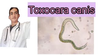 Toxocara canis toxocarose [upl. by Jessalyn]