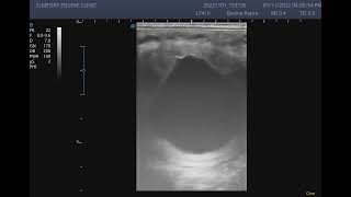 Ultrasound of 22 day old equine embryo [upl. by Thar171]