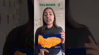 Necrosis Part 2 mbbs science medicine medlife neet medicalstudent neetpg pathology [upl. by Thorncombe713]