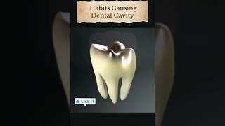 Tooth Trouble What are Cavities and How to Prevent Them 🦷दांतो की सड़न yt shorts ytshortsindia [upl. by Millian769]