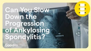 Ways To Prevent Anklylosing Spondylitis Progression  GoodRx [upl. by Aile987]