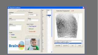 DMIT Fingerprint Analysis  Multiple Intelligences Test [upl. by Orfinger735]