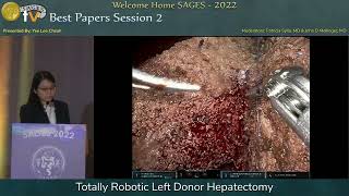 Totally Robotic Left Donor Hepatectomy [upl. by Eatnuahc]