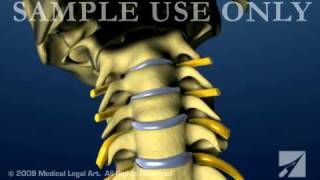 Cervical Spine and Intervertebral Disc Anatomy  Female Version [upl. by Harland]