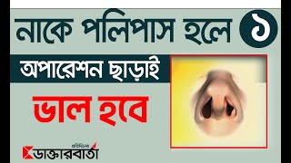 নাকের পলিপাস হলে করণীয় কি DaktarBarta [upl. by Mathilde]