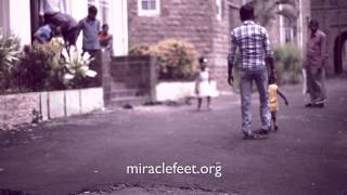 MiracleFeet is Working to End Untreated Clubfoot [upl. by Dewey290]